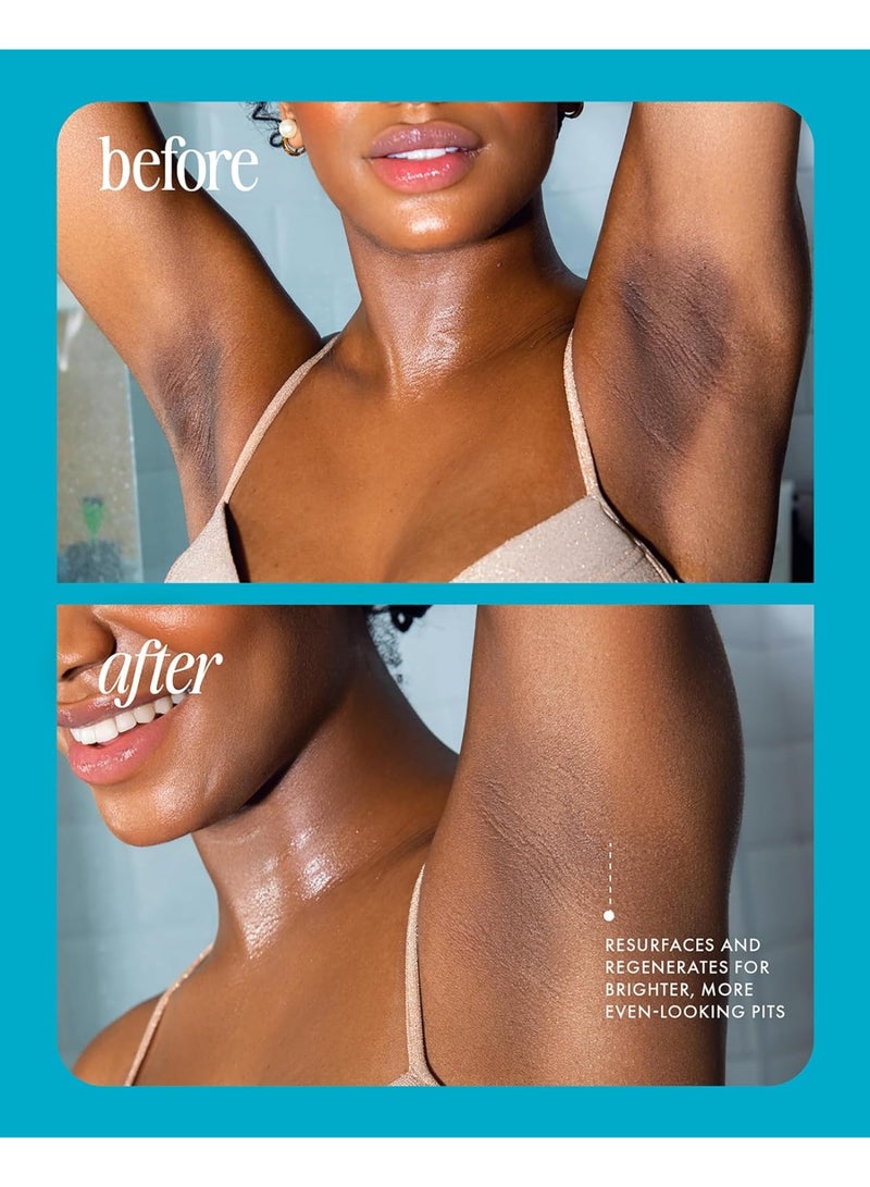 ترولي جلّ معزز لعلاج التصبغات من ترولي بيوتي - علاج سريع الامتصاص لندبات حب الشباب للوجه والجسم - مرهم لإزالة الندبات - سيروم خفيف الوزن للندبات للاستخدام اليومي 90 مل - Image 3